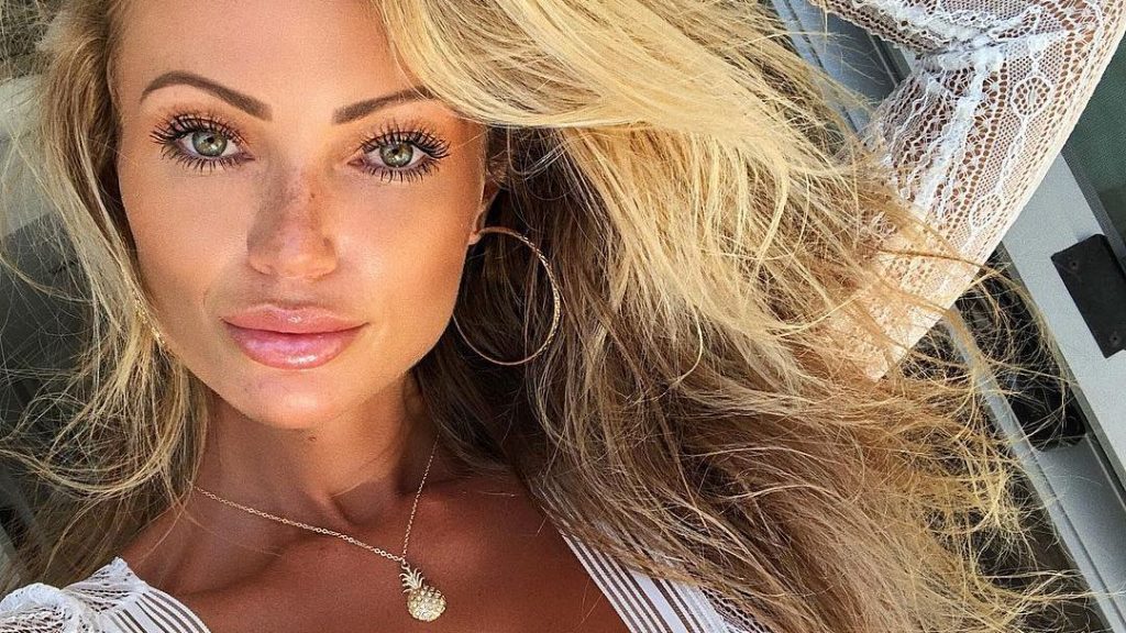 Abby Dowse botox body measurements nose job