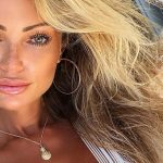 Abby Dowse botox body measurements nose job