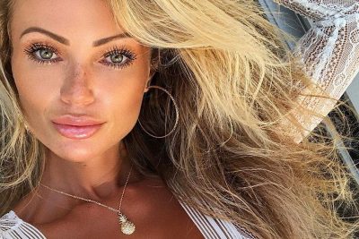 Abby Dowse botox body measurements nose job