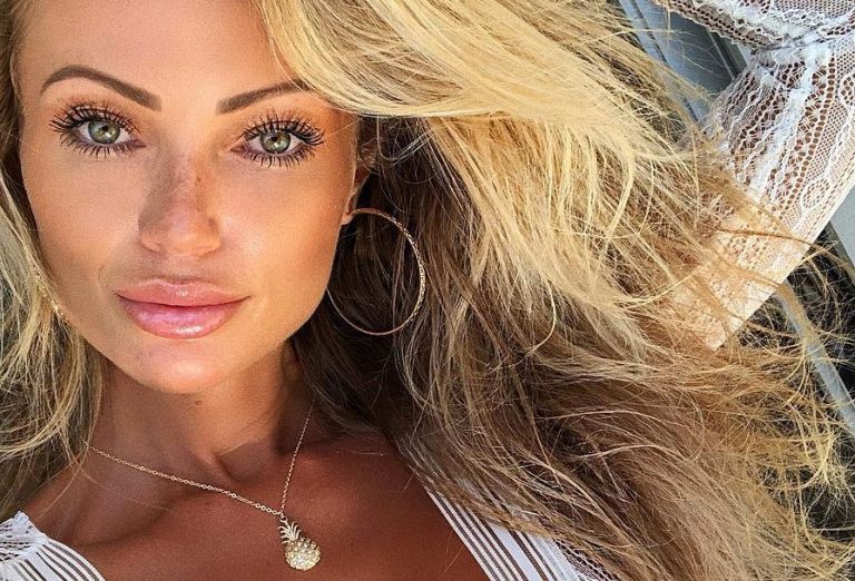 Abby Dowse botox body measurements nose job