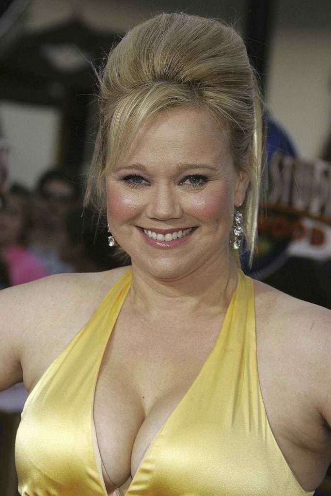 Caroline Rhea before and after plastic surgery
