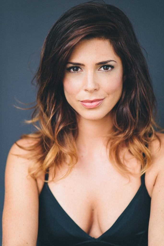 Cindy Sampson lip fillers