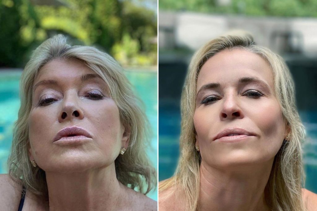 Dagen McDowell facelift botox nose job