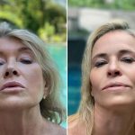 Dagen McDowell facelift botox nose job