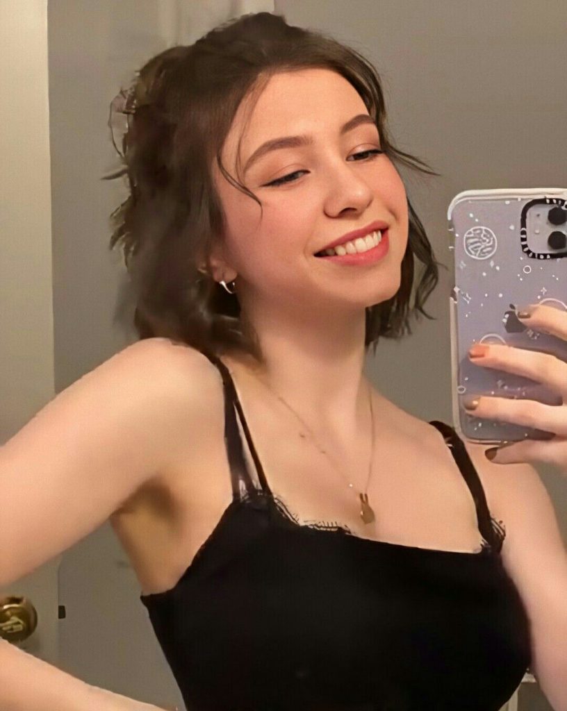 Katelyn Nacon lip fillers