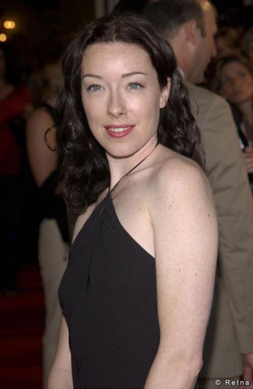 Molly Parker before and after plastic surgery