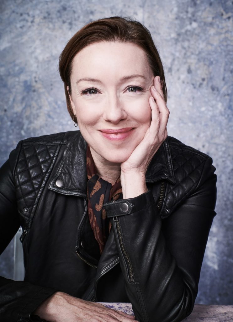 Molly Parker facelift