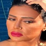 Rania Youssef lips facelift nose job