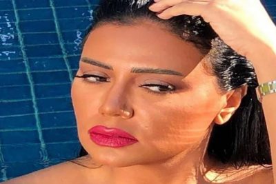 Rania Youssef lips facelift nose job