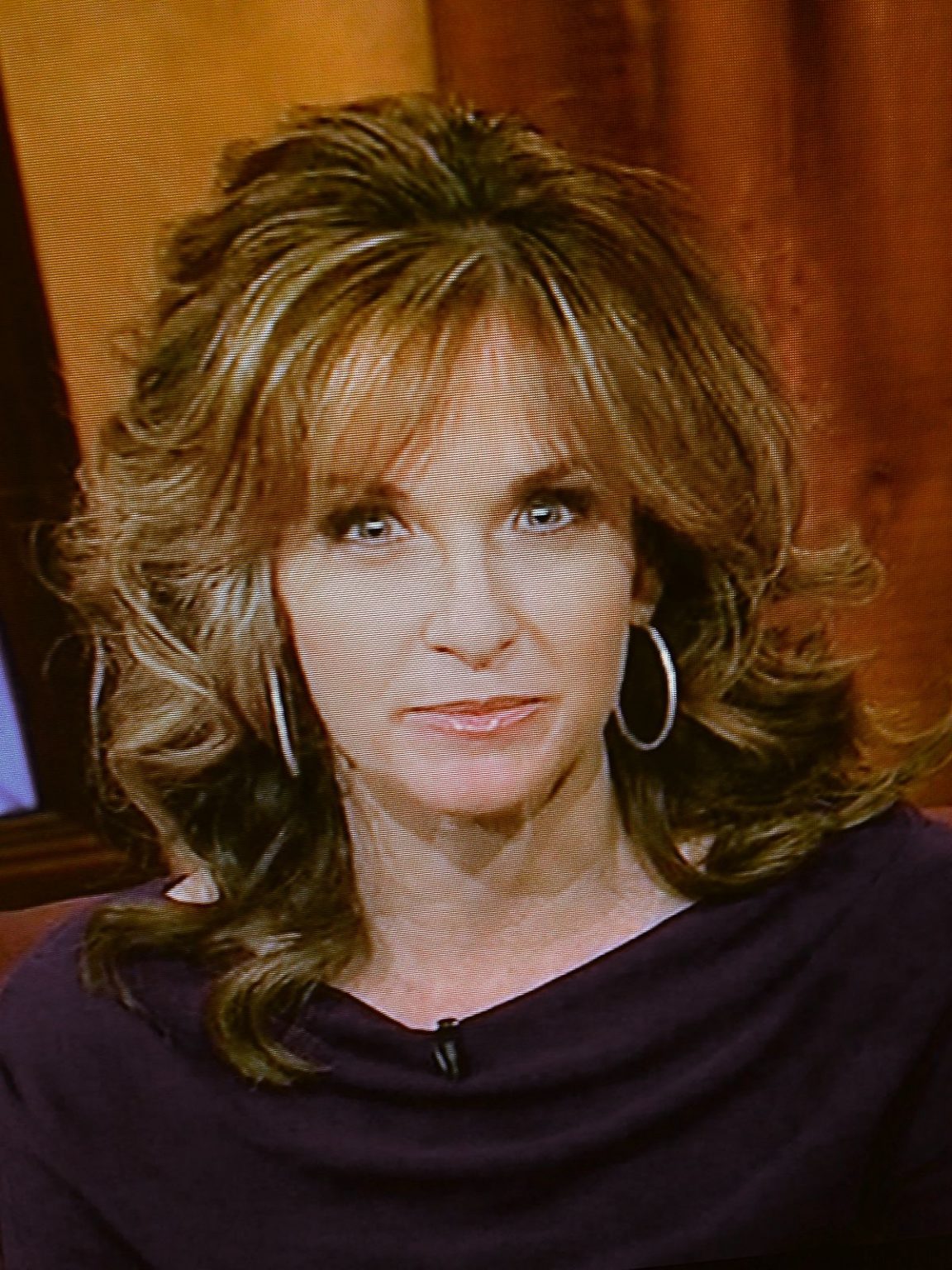 Has Suzy Kolber had Plastic Surgery? Facelift, Nose Job, Body