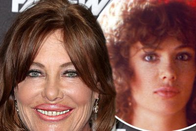 Kelly LeBrock Plastic Surgery