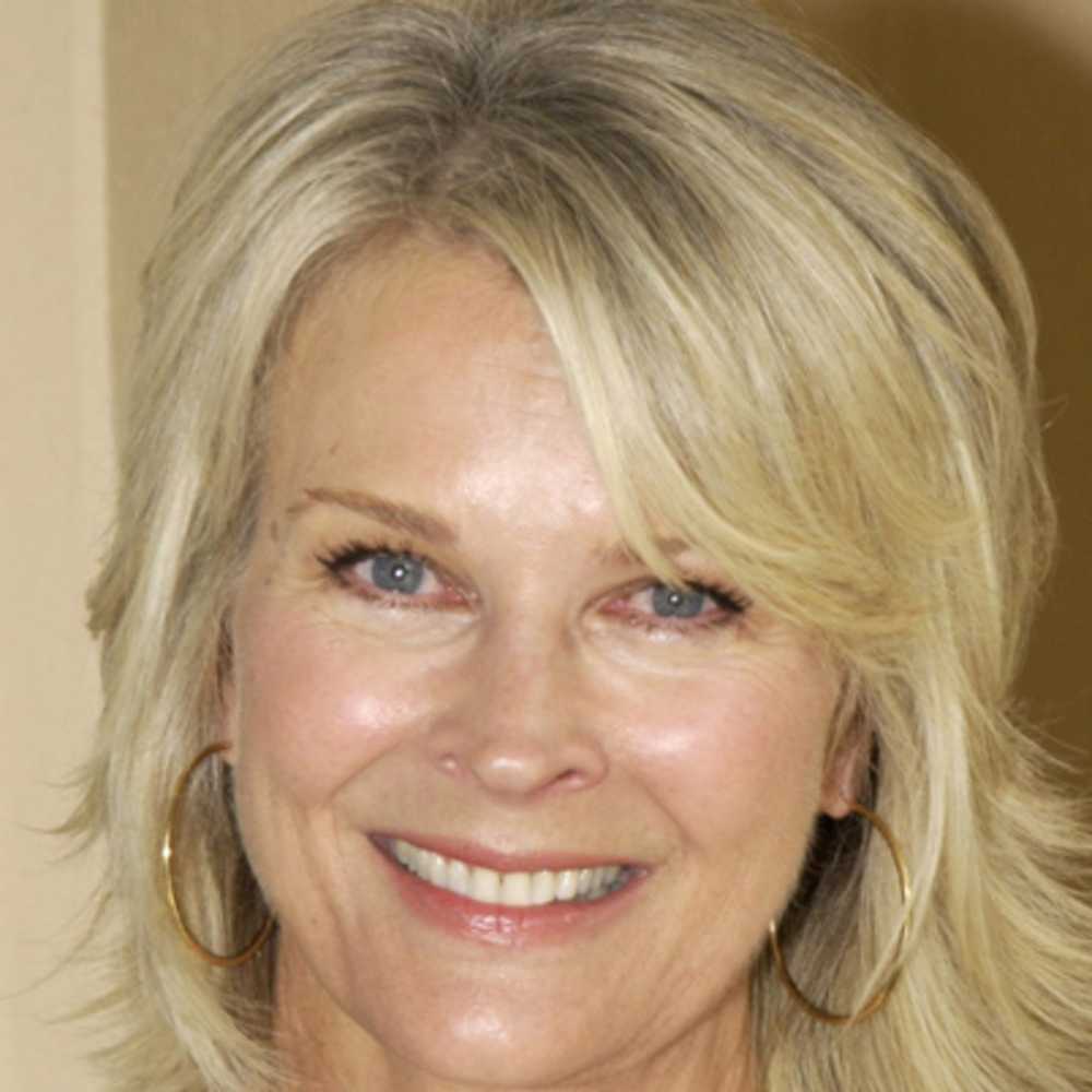 Candice Bergen Cosmetic Surgery Face