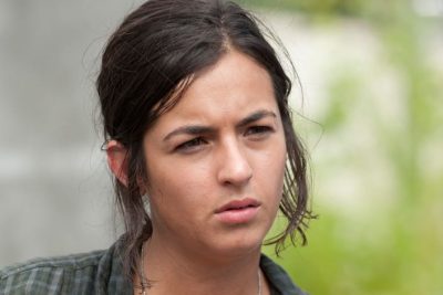 Alanna Masterson Plastic Surgery