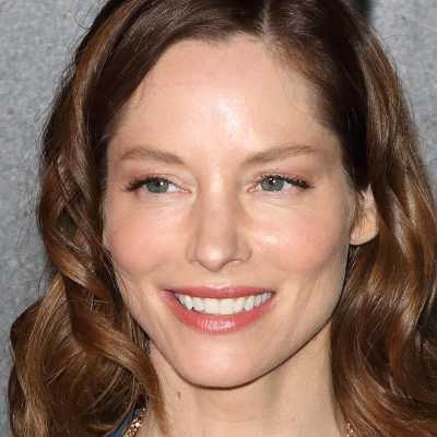 Sienna Guillory Cosmetic Surgery Face