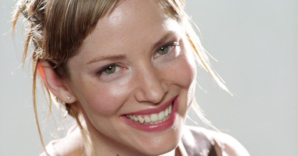 Sienna Guillory Plastic Surgery and Body Measurements