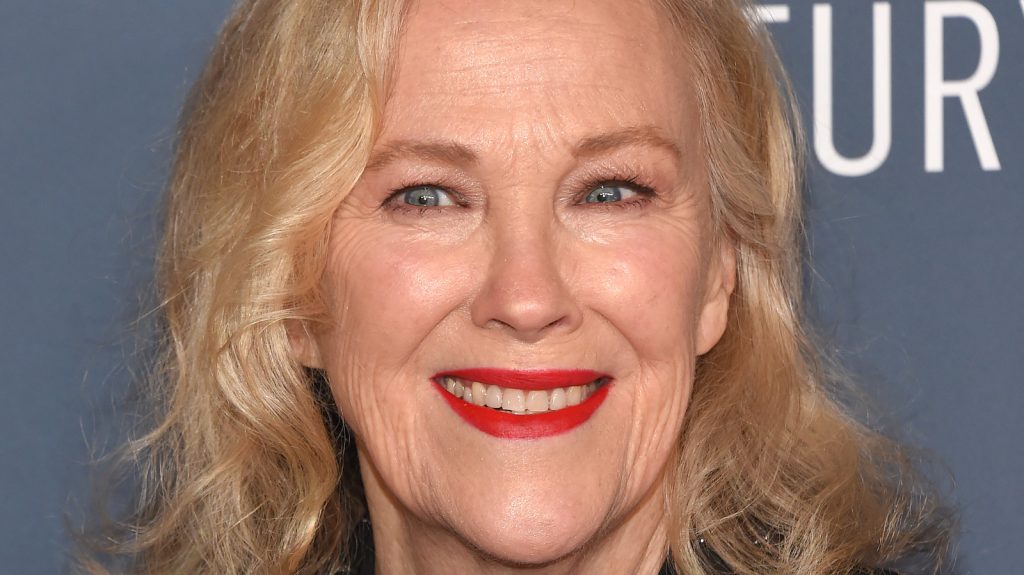 Catherine O'Hara Cosmetic Surgery