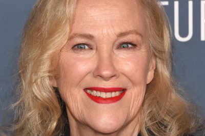 Catherine O'Hara Cosmetic Surgery