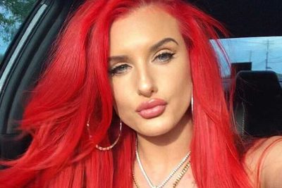 Justina Valentine Plastic Surgery Procedures