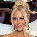 Dorit Kemsley Botox and Fillers