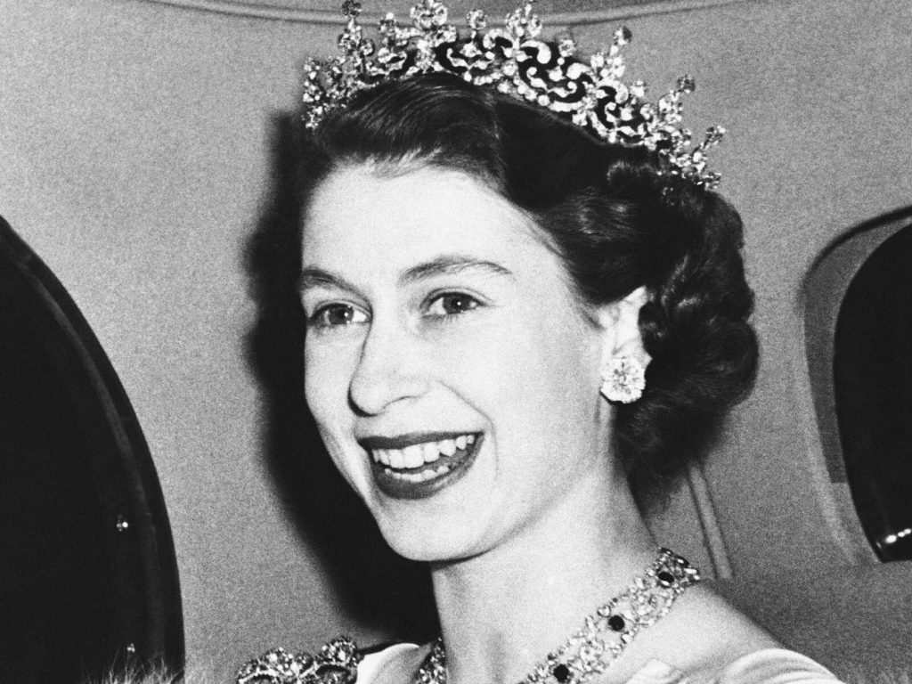 Queen Elizabeth Cosmetic Surgery Face