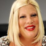 Tori Spelling Cosmetic Surgery