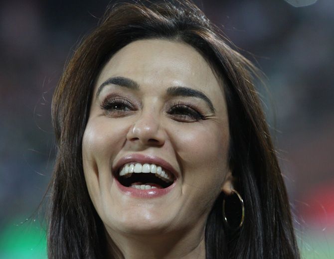 Preity Zinta Botox, Facelift, and Lips