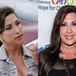 Jacqueline Laurita Plastic Surgery Procedures