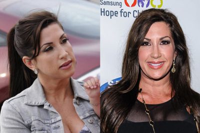 Jacqueline Laurita Plastic Surgery Procedures