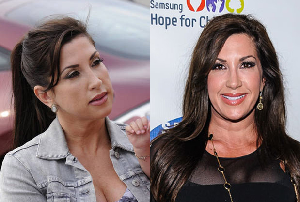 Jacqueline Laurita Plastic Surgery Procedures